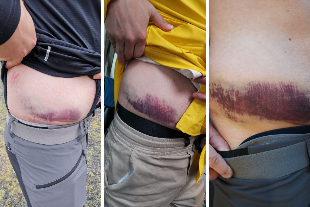 Kalastusreissulla iskun saanut kylki koki melkoisen värimuutoksen road tripin aikana